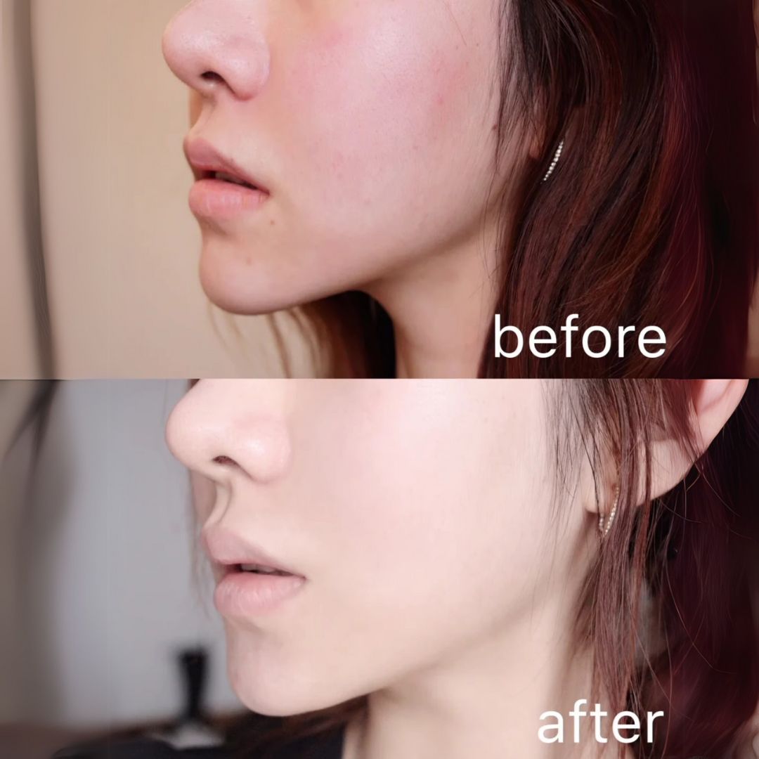 Biossance Squalane + Vitamin C Rose Firming Oil