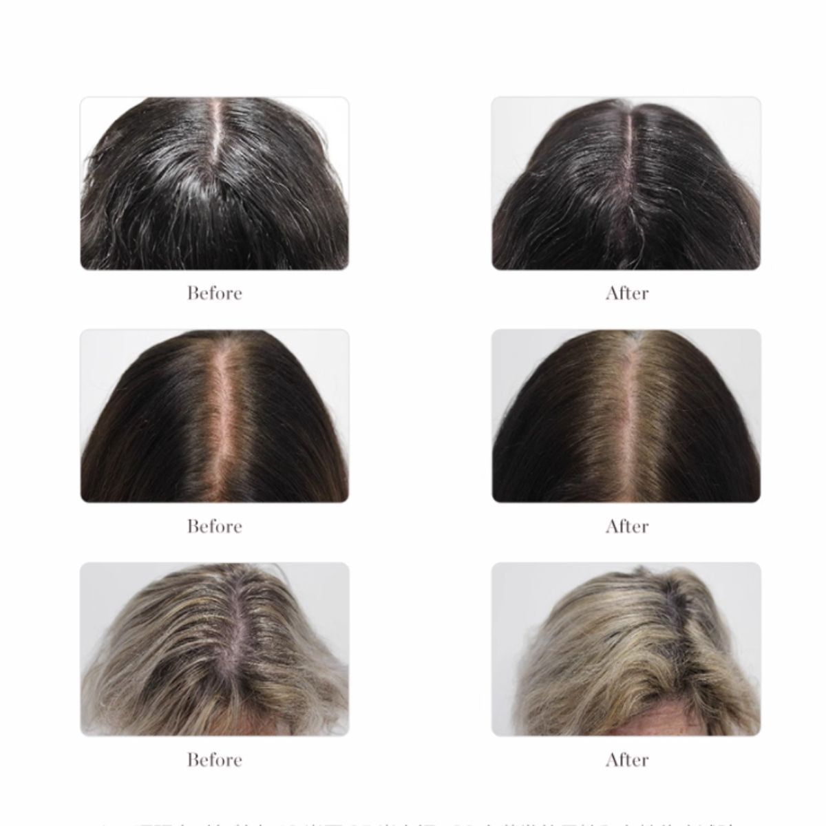 Larimide Kojaxin Stops Hair loss & Stimulates Growth Ampous (15 X 4ml)
