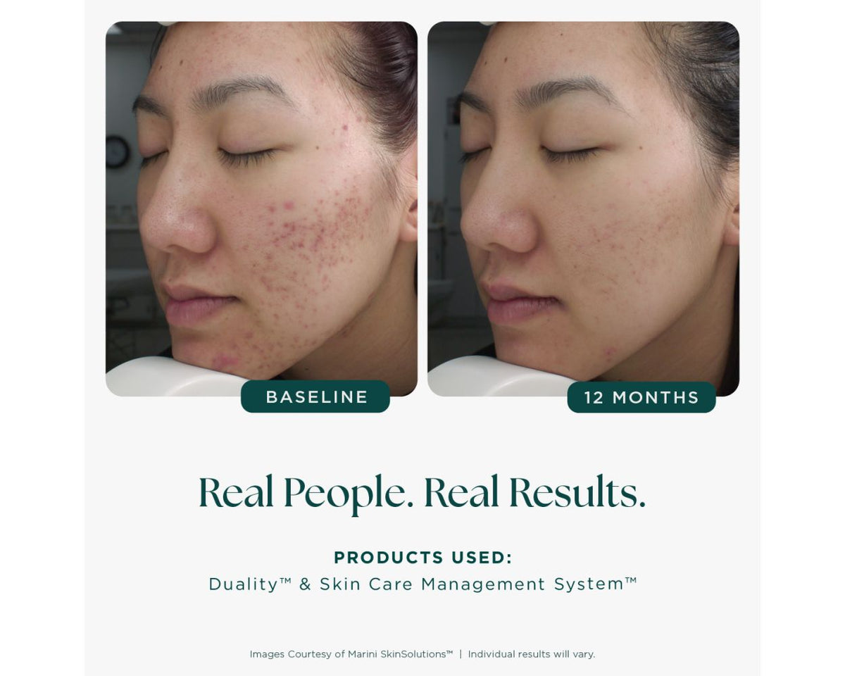 Marini SkinSolutions™ Duality™ - 1 fl. oz.