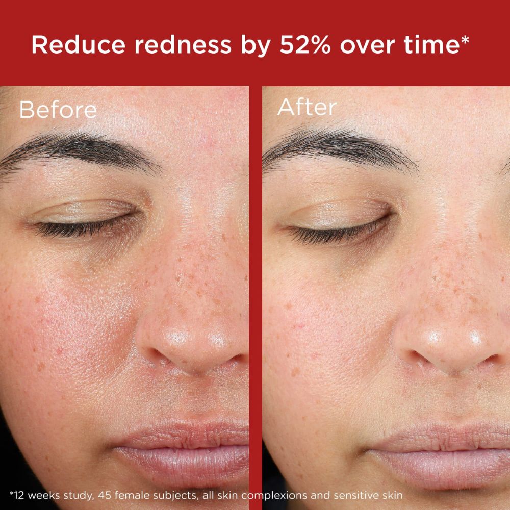 EltaMD UV Skin Recovery Red Color Correcting Green Tint Broad Spectrum SPF 50