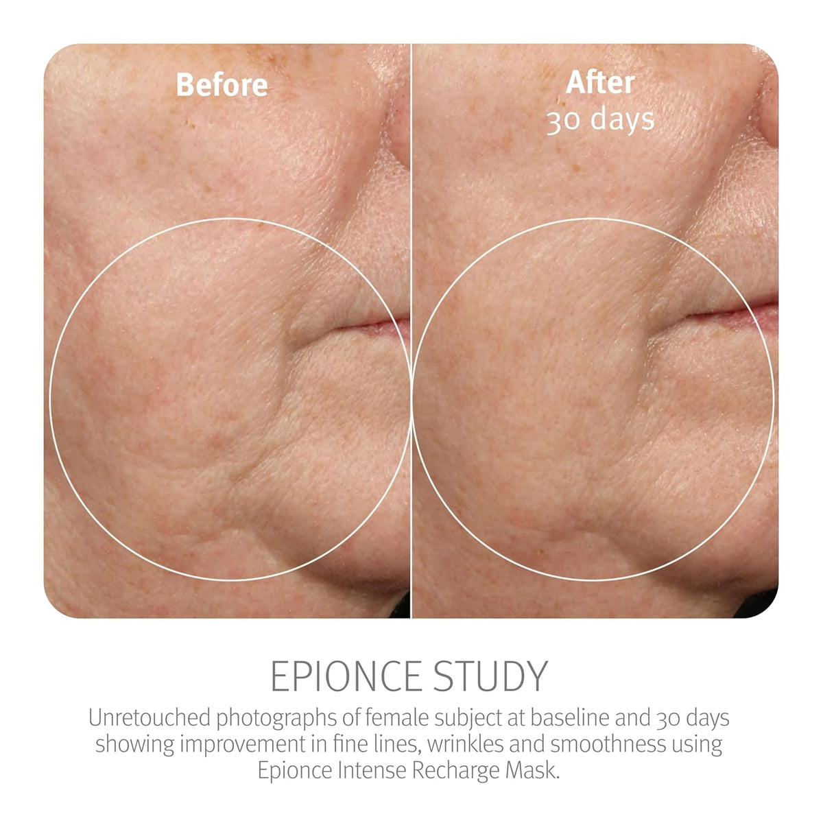 Epionce Intense Recharge Mask