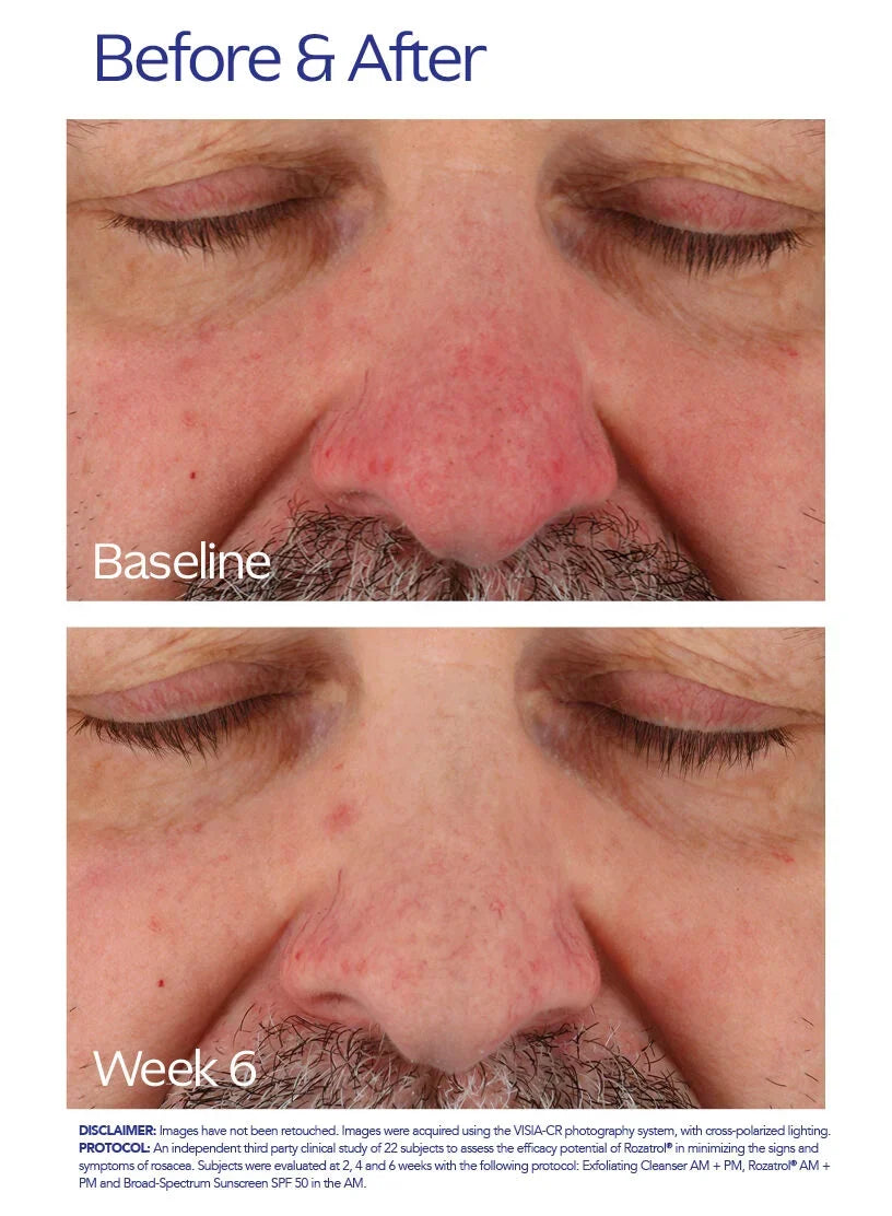 ZO Skin Health Rozatrol®