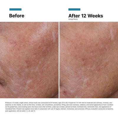 SkinCeuticals Hyaluronic Acid Intensifier Multi-Glycan