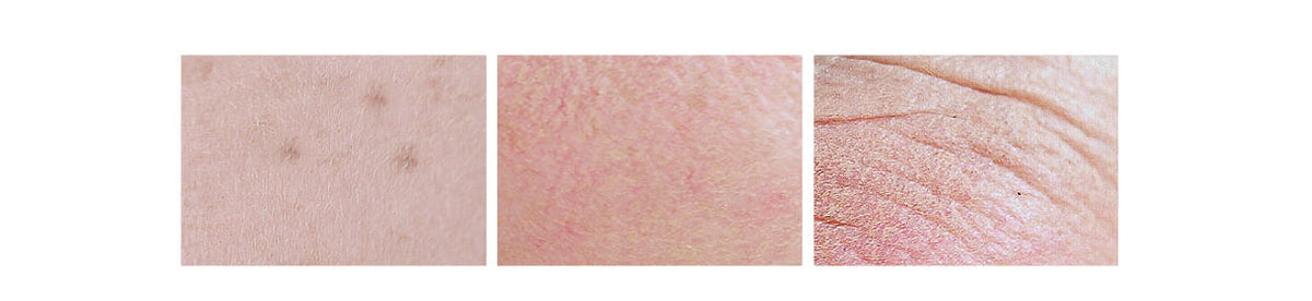 REJURAN Derma Healer Moisture Cream 60g
