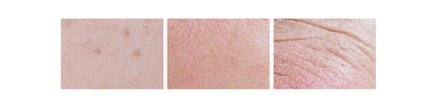 REJURAN Derma Healer Moisture Cream 60g