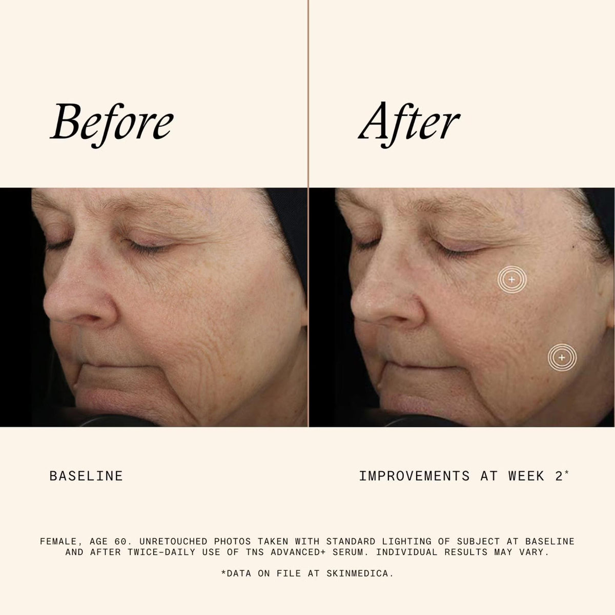 SkinMedica TNS Advanced+ Serum