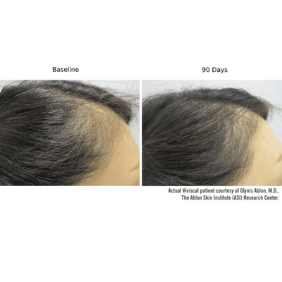 Viviscal PRO Hair Growth Supplement - 180 Tablets