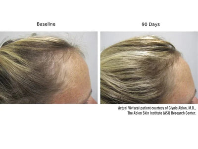 Viviscal PRO Hair Growth Supplement - 180 Tablets